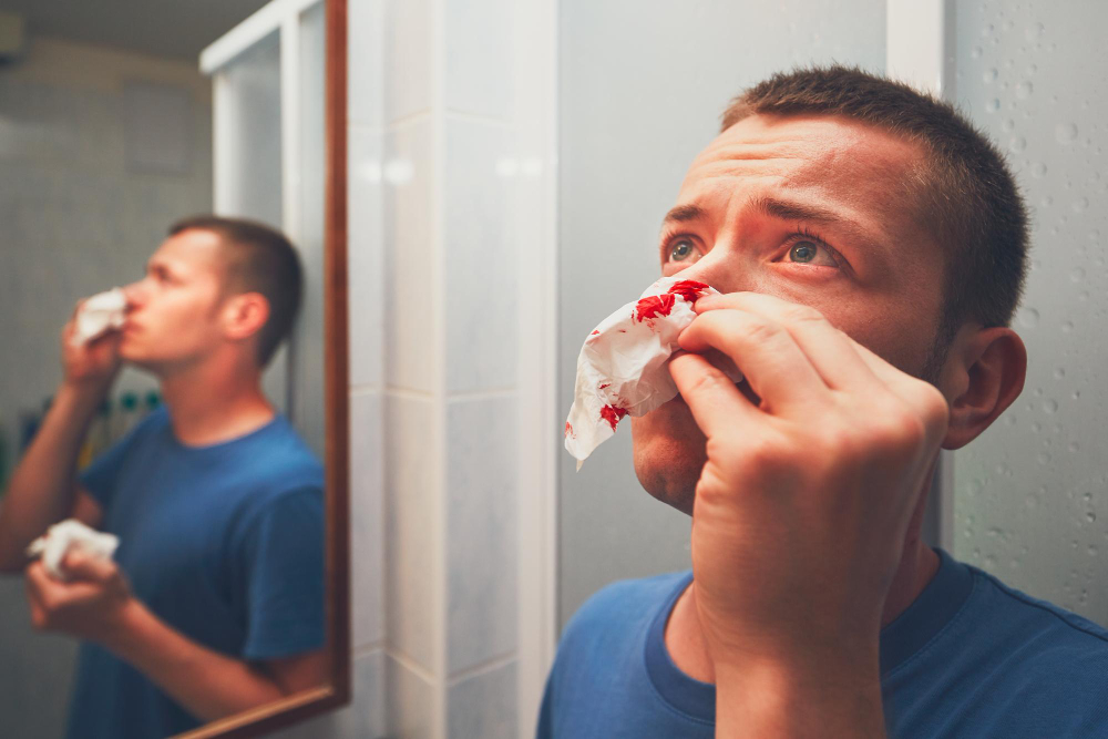 Nosebleeds (Epistaxis): First Aid and When to See an ENT